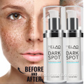 Dark Spot Corrector Serum